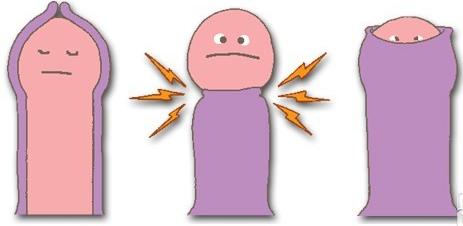 什么叫包皮过长