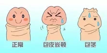 包皮包茎到底是怎么回事